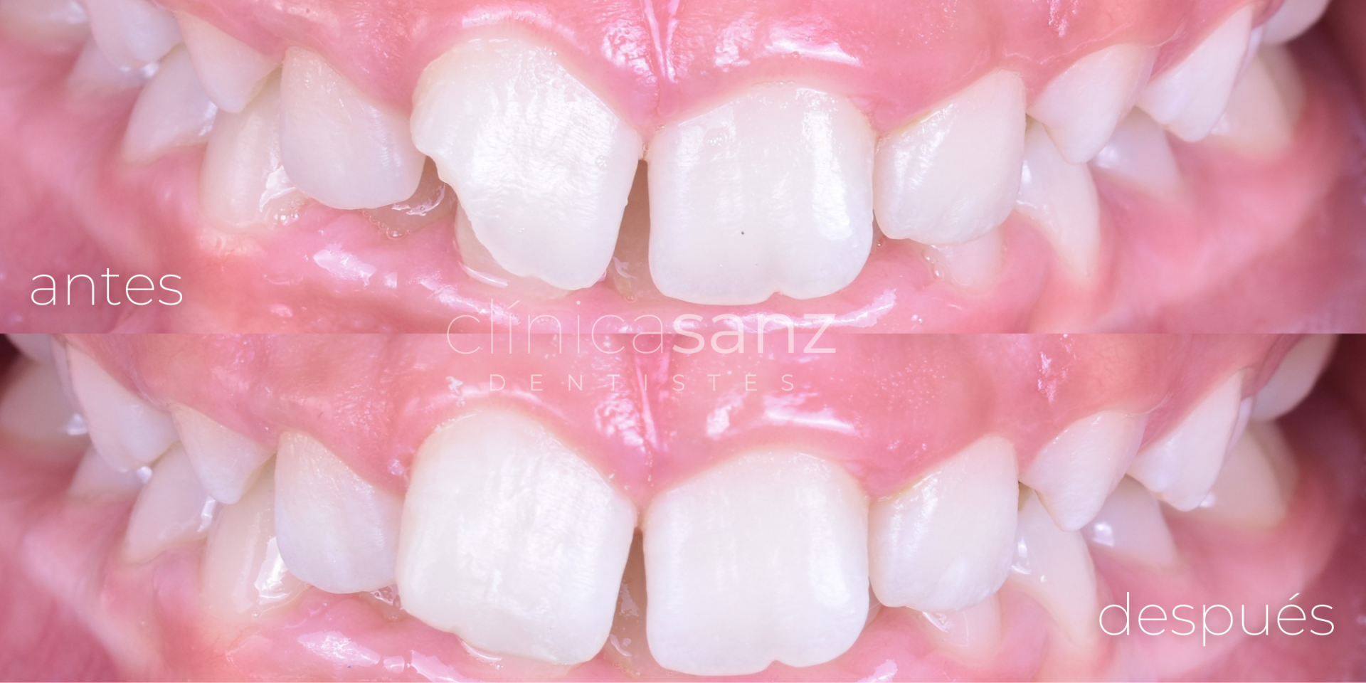 Estética dental Estética dental