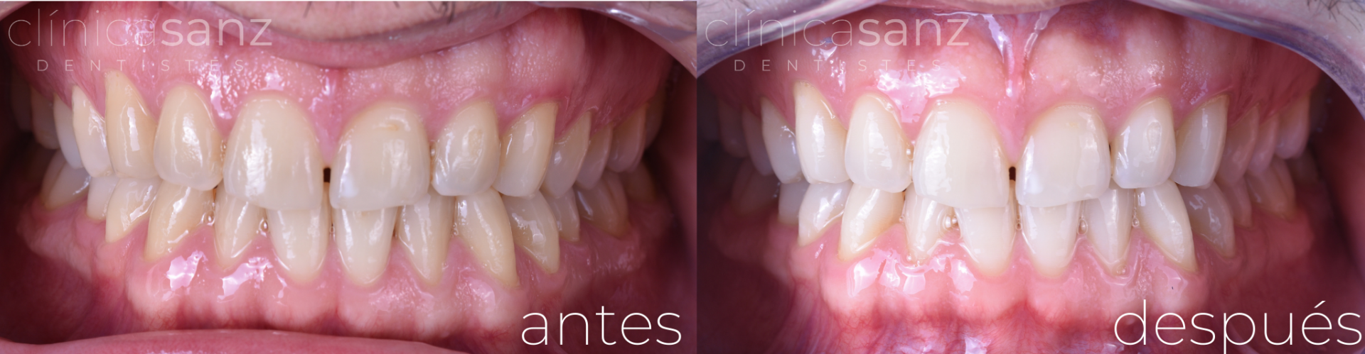 Estética dental Estética dental