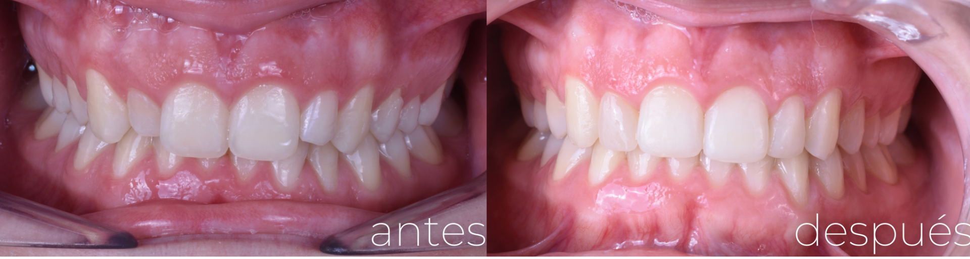 Estética dental Estética dental